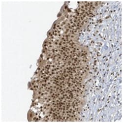 ZNF740, Rabbit, Polyclonal Antibody, Abnova 100 &mu;L | Buy Online | Abnova Corporation | Fisher Scientific