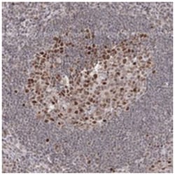 IWS1, Rabbit, Polyclonal Antibody, Abnova 100 &mu;L | Buy Online | Abnova Corporation | Fisher Scientific