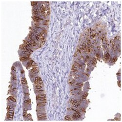 LRRC34, Rabbit, Polyclonal Antibody, Abnova 100&mu;L; Unlabeled:Antibodies,