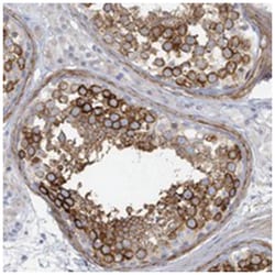 DOCK10, Rabbit, Polyclonal Antibody, Abnova 100 &mu;L | Buy Online | Abnova Corporation | Fisher Scientific