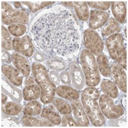 EEFSEC, Rabbit, Polyclonal Antibody, Abnova 100 &mu;L | Buy Online | Abnova Corporation | Fisher Scientific