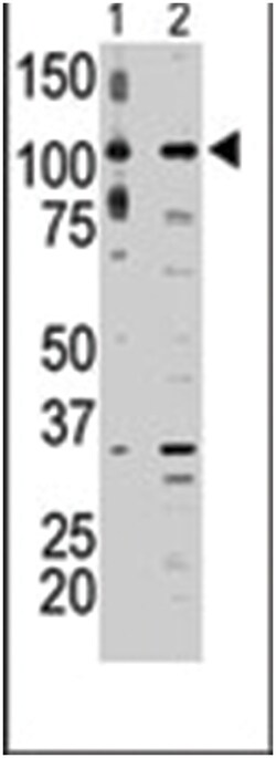 MAP3K9, Rabbit, Polyclonal Antibody, Abnova 400&mu;L; Unlabeled:Antibodies,