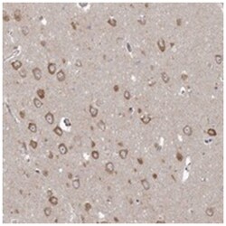 PPP2R3A Rabbit anti-Human, Polyclonal Antibody, Abnova 100&mu;L; Unlabeled:Antibodies,
