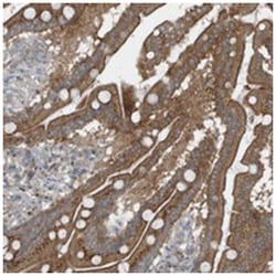 GCC2, Rabbit, Polyclonal Antibody, Abnova 100&mu;L; Unlabeled:Antibodies,
