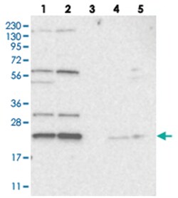 MED28 Rabbit anti-Human, Mouse, Rat, Polyclonal Antibody, Abnova 100&mu;L;