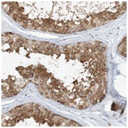 ARD1B, Rabbit, Polyclonal Antibody, Abnova 100&mu;L; Unlabeled:Antibodies,