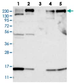 ARAP2, Rabbit, Polyclonal Antibody, Abnova 100&mu;L; Unlabeled:Antibodies,