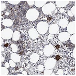 ARAP2, Rabbit, Polyclonal Antibody, Abnova 100&mu;L; Unlabeled:Antibodies,