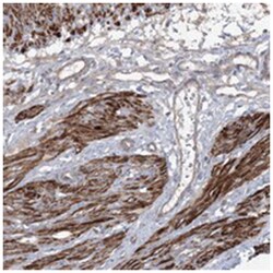 ZSWIM6, Rabbit, Polyclonal Antibody, Abnova 100&mu;L; Unlabeled:Antibodies,