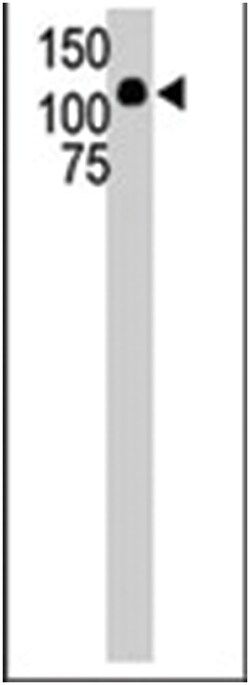 MAP3K10, Rabbit, Polyclonal Antibody, Abnova 400 &mu;L | Buy Online | Abnova | Fisher Scientific