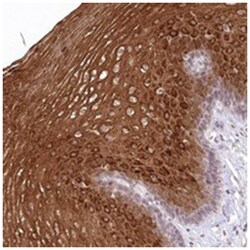 RBM27 Rabbit anti-Human, Polyclonal Antibody, Abnova 100 &mu;L | Buy Online | Abnova Corporation | Fisher Scientific