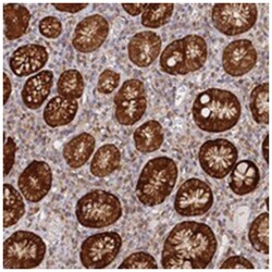 PAIP2, Rabbit, Polyclonal Antibody, Abnova 100 &mu;L | Buy Online | Abnova Corporation | Fisher Scientific