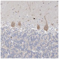 SDAD1, Rabbit, Polyclonal Antibody, Abnova 100 &mu;L | Buy Online | Abnova Corporation | Fisher Scientific