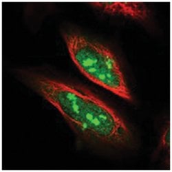 SDAD1, Rabbit, Polyclonal Antibody, Abnova 100 &mu;L | Buy Online | Abnova Corporation | Fisher Scientific