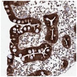 ZNF488, Rabbit, Polyclonal Antibody, Abnova 100 &mu;L | Buy Online | Abnova Corporation | Fisher Scientific