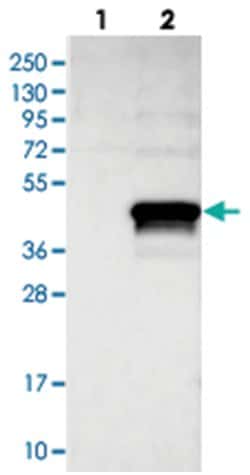 ZNF488, Rabbit, Polyclonal Antibody, Abnova 100 &mu;L | Buy Online | Abnova Corporation | Fisher Scientific