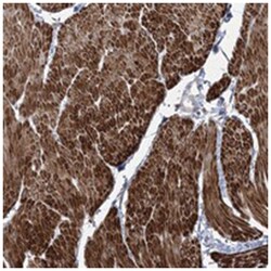 ZSCAN23, Rabbit, Polyclonal Antibody, Abnova 100 &mu;L | Buy Online | Abnova Corporation | Fisher Scientific