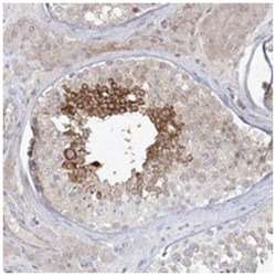 ADAMTS12, Rabbit, Polyclonal Antibody, Abnova 100&mu;L; Unlabeled:Antibodies,