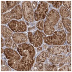 FEZ2 Rabbit anti-Human, Polyclonal Antibody, Abnova 100 &mu;L | Buy Online | Abnova Corporation | Fisher Scientific