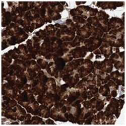 DNAJB14, Rabbit, Polyclonal Antibody, Abnova 100 &mu;L | Buy Online | Abnova Corporation | Fisher Scientific