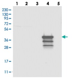 LMOD3, Rabbit, Polyclonal Antibody, Abnova 100 &mu;L | Buy Online | Abnova Corporation | Fisher Scientific