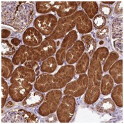 LMOD3, Rabbit, Polyclonal Antibody, Abnova 100 &mu;L | Buy Online | Abnova Corporation | Fisher Scientific