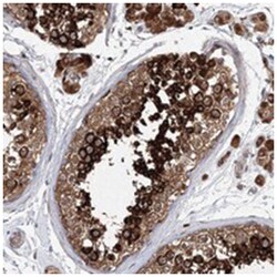 C1orf14, Rabbit, Polyclonal Antibody, Abnova 100 &mu;L | Buy Online | Abnova | Fisher Scientific
