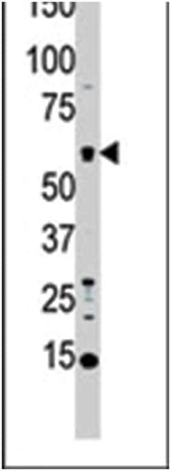 STK4 Rabbit anti-Human, Polyclonal Antibody, Abnova 400 &mu;L | Buy Online | Abnova Corporation | Fisher Scientific