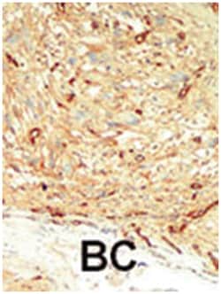 STK4 Rabbit anti-Human, Polyclonal Antibody, Abnova 400 &mu;L | Buy Online | Abnova Corporation | Fisher Scientific