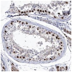 HKR1 Rabbit anti-Human, Polyclonal Antibody, Abnova 100&mu;L; Unlabeled:Antibodies,