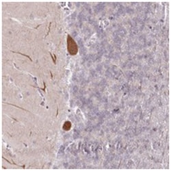 AMTN, Rabbit, Polyclonal Antibody, Abnova 100 &mu;L | Buy Online | Abnova Corporation | Fisher Scientific