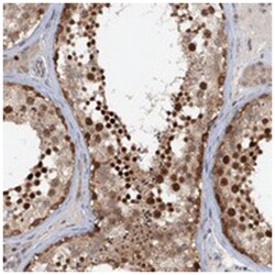 TAS2R42, Rabbit, Polyclonal Antibody, Abnova 100 &mu;L | Buy Online | Abnova Corporation | Fisher Scientific