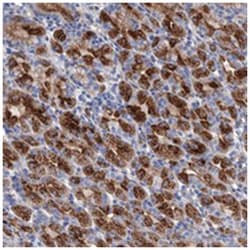 GPR155, Rabbit, Polyclonal Antibody, Abnova 100 &mu;L | Buy Online | Abnova Corporation | Fisher Scientific