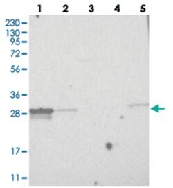 MITD1, Rabbit, Polyclonal Antibody, Abnova 100 &mu;L | Buy Online | Abnova Corporation | Fisher Scientific