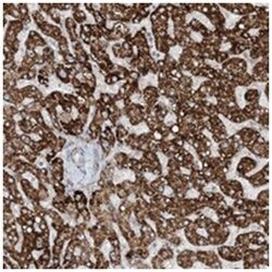 MITD1, Rabbit, Polyclonal Antibody, Abnova 100 &mu;L | Buy Online | Abnova Corporation | Fisher Scientific