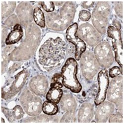 FAM126B, Rabbit, Polyclonal Antibody, Abnova 100 &mu;L | Buy Online | Abnova Corporation | Fisher Scientific