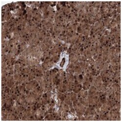 ANKAR, Rabbit, Polyclonal Antibody, Abnova 100 &mu;L | Buy Online | Abnova Corporation | Fisher Scientific