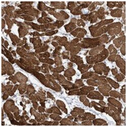 ZNF654, Rabbit, Polyclonal Antibody, Abnova 100 &mu;L | Buy Online | Abnova Corporation | Fisher Scientific