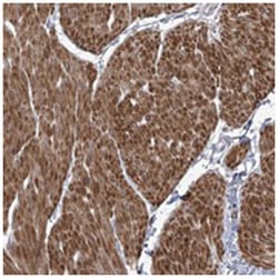 ANKRD23, Rabbit, Polyclonal Antibody, Abnova 100 &mu;L | Buy Online | Abnova Corporation | Fisher Scientific