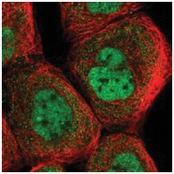 ANKRD23, Rabbit, Polyclonal Antibody, Abnova 100 &mu;L | Buy Online | Abnova Corporation | Fisher Scientific