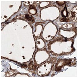 WDR49, Rabbit, Polyclonal Antibody, Abnova 100 &mu;L | Buy Online | Abnova Corporation | Fisher Scientific