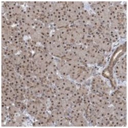 CCDC152, Rabbit, Polyclonal Antibody, Abnova 100 &mu;L | Buy Online | Abnova Corporation | Fisher Scientific