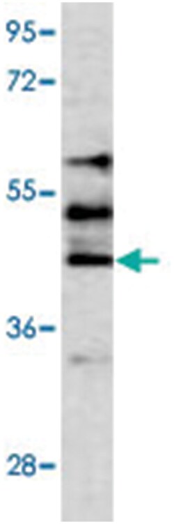 STK24, Rabbit, Polyclonal Antibody, Abnova 400&mu;L; Unlabeled:Antibodies,