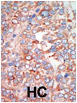 STK24, Rabbit, Polyclonal Antibody, Abnova 400&mu;L; Unlabeled:Antibodies,