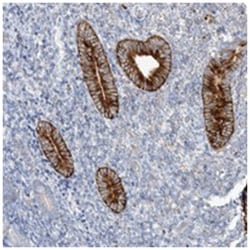 UROC1, Rabbit, Polyclonal Antibody, Abnova 100 &mu;L | Buy Online | Abnova Corporation | Fisher Scientific