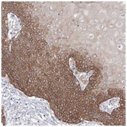 FAM55C, Rabbit, Polyclonal Antibody, Abnova 100 &mu;L | Buy Online | Abnova Corporation | Fisher Scientific