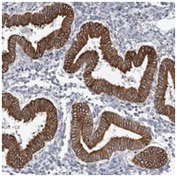 PLEKHG4B, Rabbit, Polyclonal Antibody, Abnova 100&mu;L; Unlabeled:Antibodies,