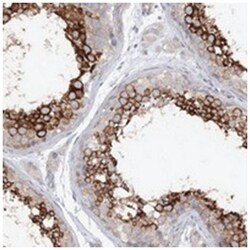 LARP2, Rabbit, Polyclonal Antibody, Abnova 100&mu;L; Unlabeled:Antibodies,