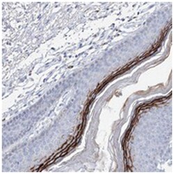 SPINK7, Rabbit, Polyclonal Antibody, Abnova 100 &mu;L | Buy Online | Abnova Corporation | Fisher Scientific