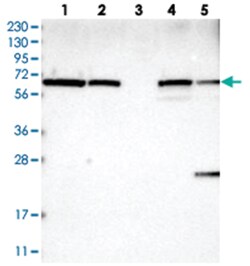 UBXN4, Rabbit, Polyclonal Antibody, Abnova 100&mu;L; Unlabeled:Antibodies,